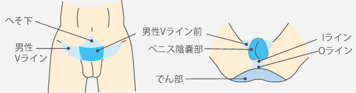 人気no 3 男性陰部脱毛 アンダーヘアー メンズ脱毛 福岡博多駅前通中央クリニック